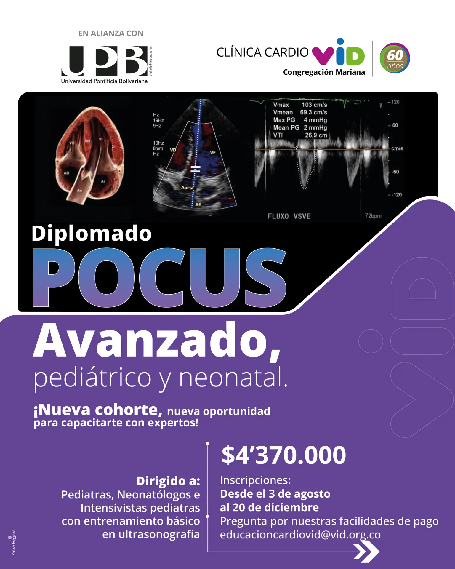Pocus avanzado final - C_Mesa de trabajo 1 copia 3 (1)